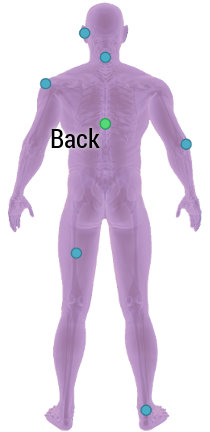 Back Injury Zones Image